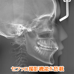 矯正治療時に実施するセファロ撮影機能を搭載