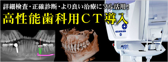 高性能歯科用ＣＴ導入！ 詳細な検査、正確な診断、より良い治療にフル活用！