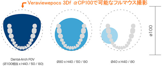 Veraviewepocs 3Df αCP100で可能なフルマウス撮影