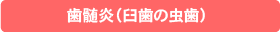 歯髄炎（臼歯の虫歯）