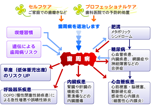 歯周病が全身におよぼす影響