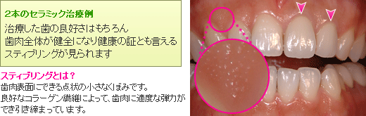 審美歯科治療だからできる！　こだわりの歯科治療！