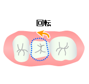 回転