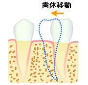 歯体移動