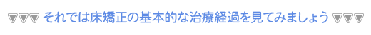 それでは床矯正の基本的な治療経過を見てみましょう