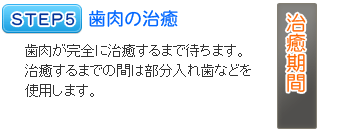 インプラント治療の流れ